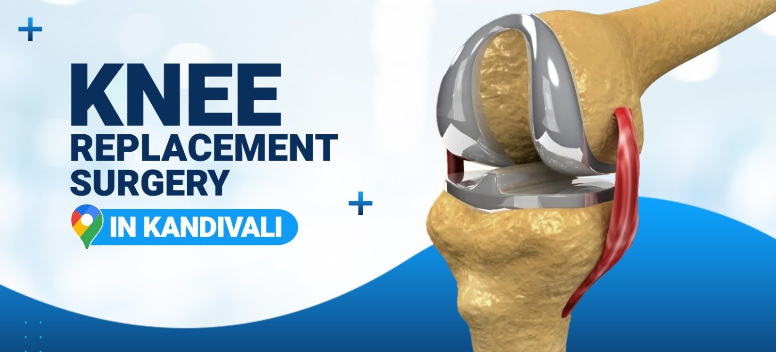 Knee Replacement Surgery in Kandivali